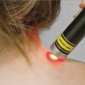 Laser X: tecnologia innovativa
