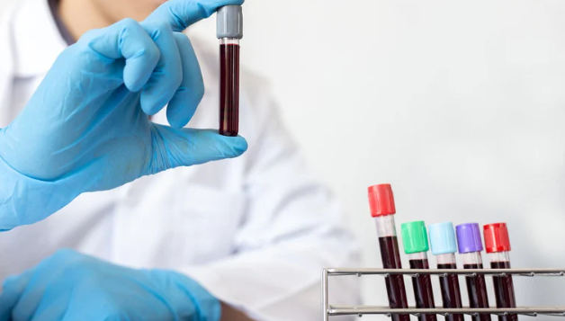 Le analisi del sangue come strumento di prevenzione